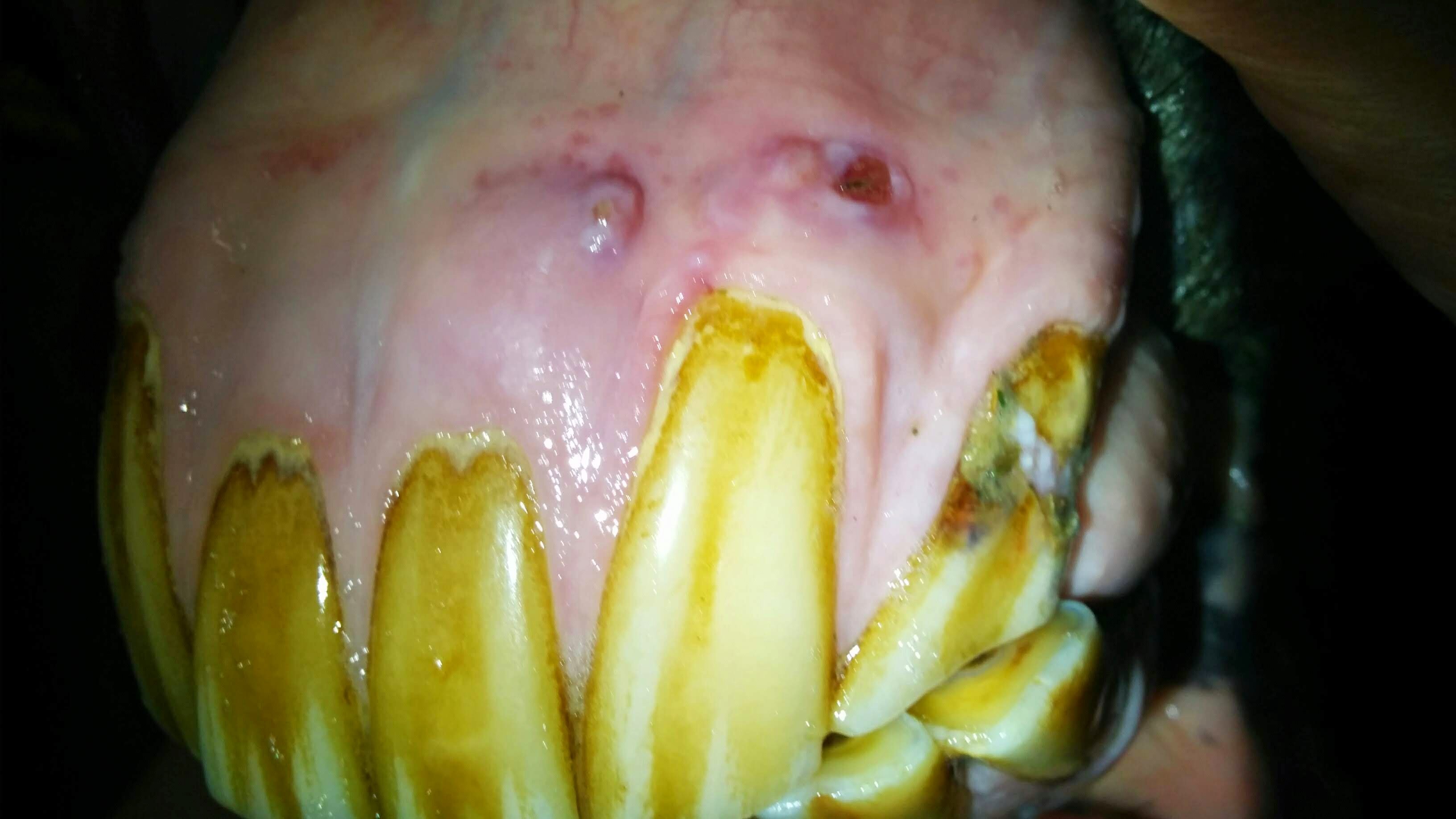 EOTRH with recessed gum, discharging tracts and a fractured corner incisor EOTRH equine teeth