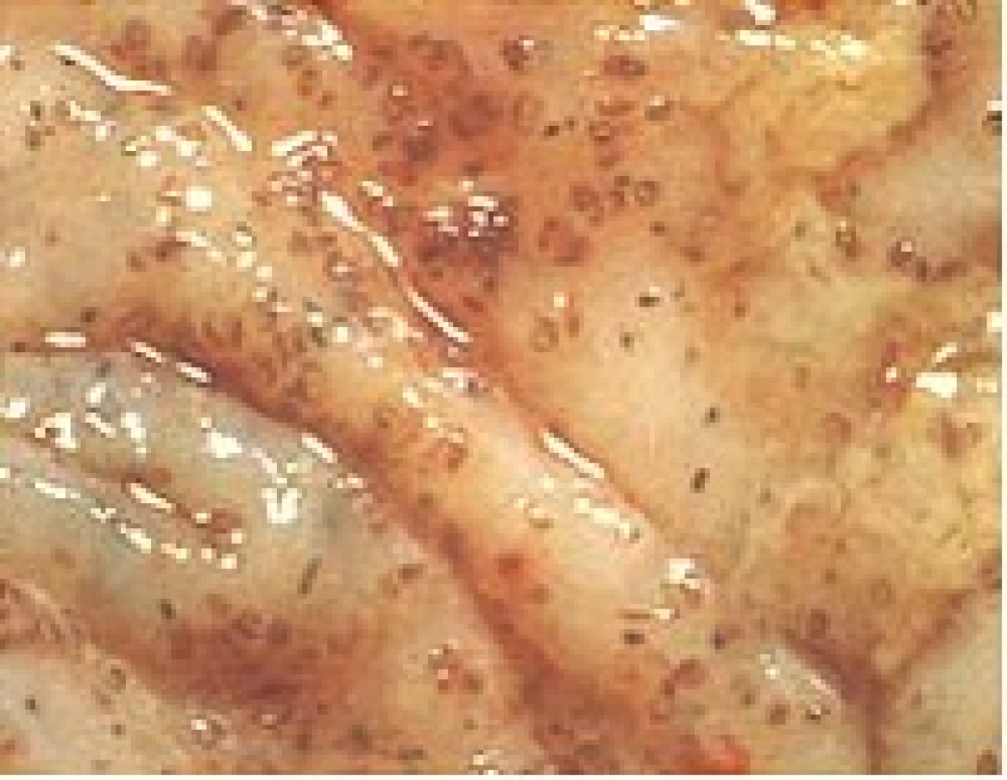 CyathosGut