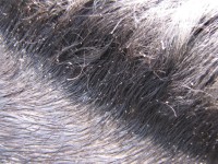 lice_and_eggs