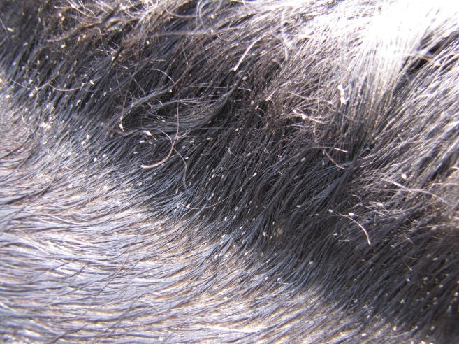 lice_and_eggs